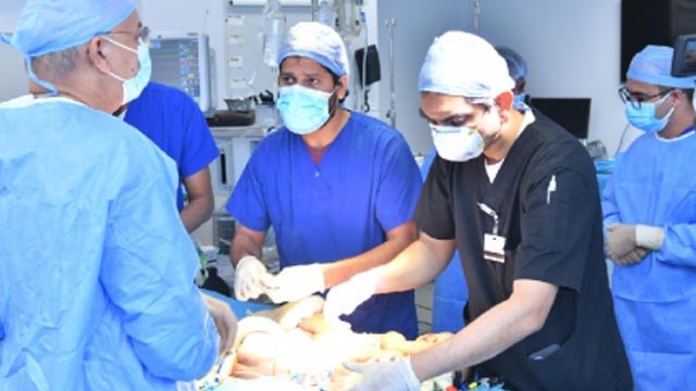 Surgeons conjoined sisters Karachi