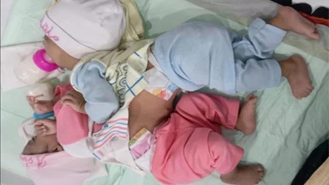 Surgeons successfully separate conjoined sisters in Karachi