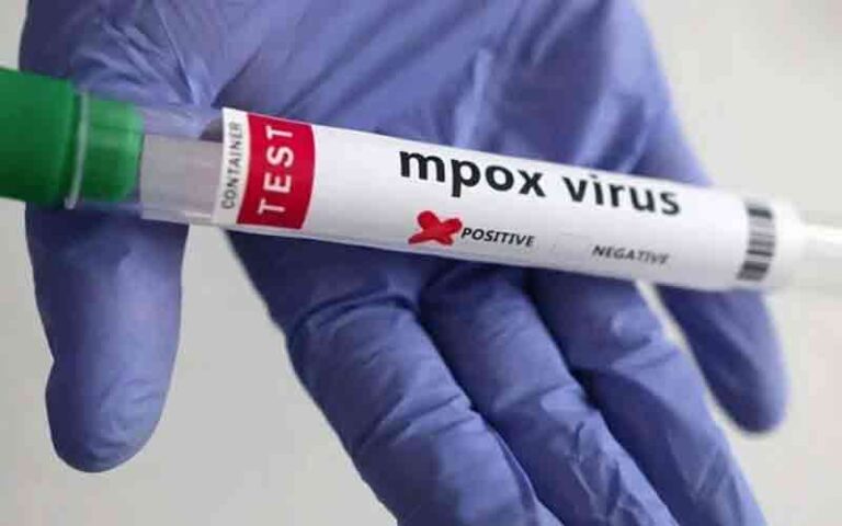 Karachi mpox