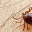 Congo virus case