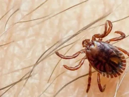 Congo virus case