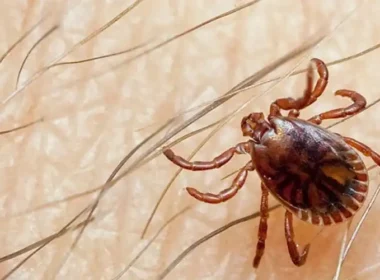 Congo virus case