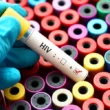 HIV treatment gap in Pakistan