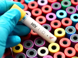 HIV treatment gap in Pakistan