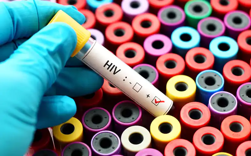 HIV treatment gap in Pakistan