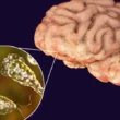 Naegleria fowleri death Karachi