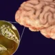 Karachi Naegleria case