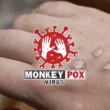 Karachi monkeypox case