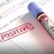 HIV cases Karachi