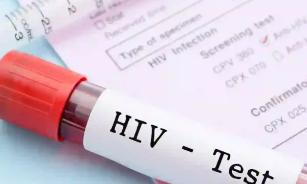 Karachi HIV cases