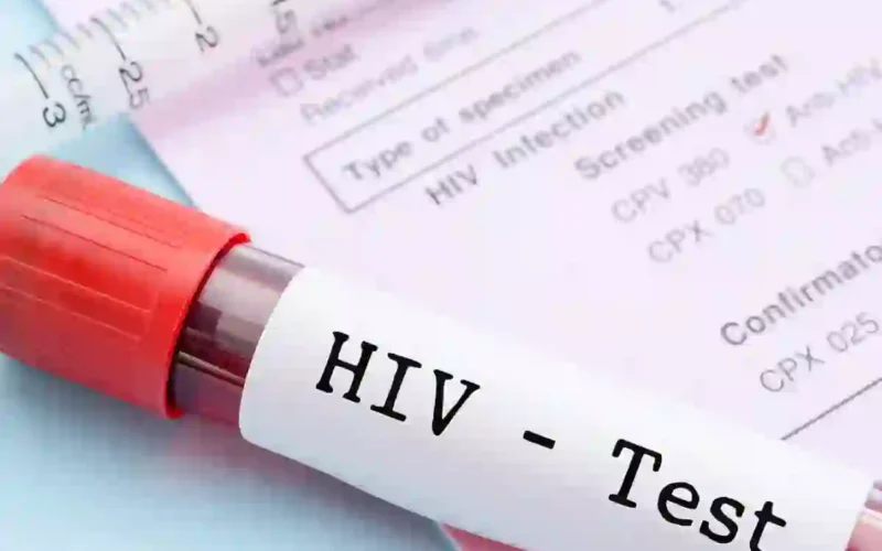Karachi HIV cases