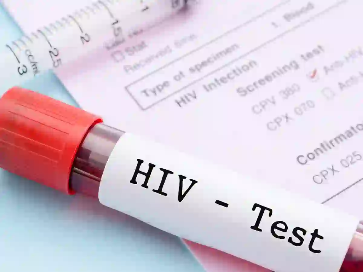 Karachi HIV cases