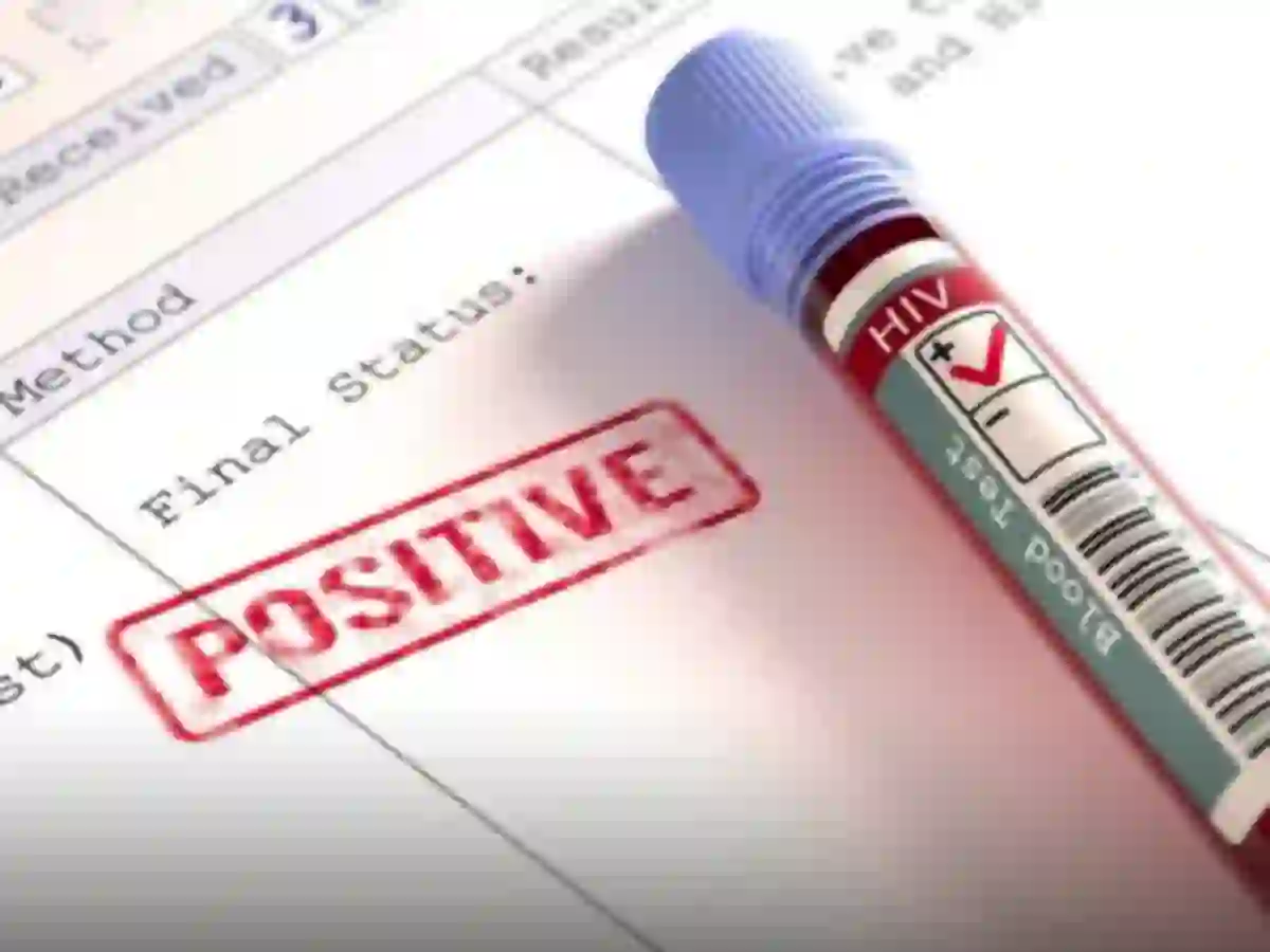 HIV cases Karachi